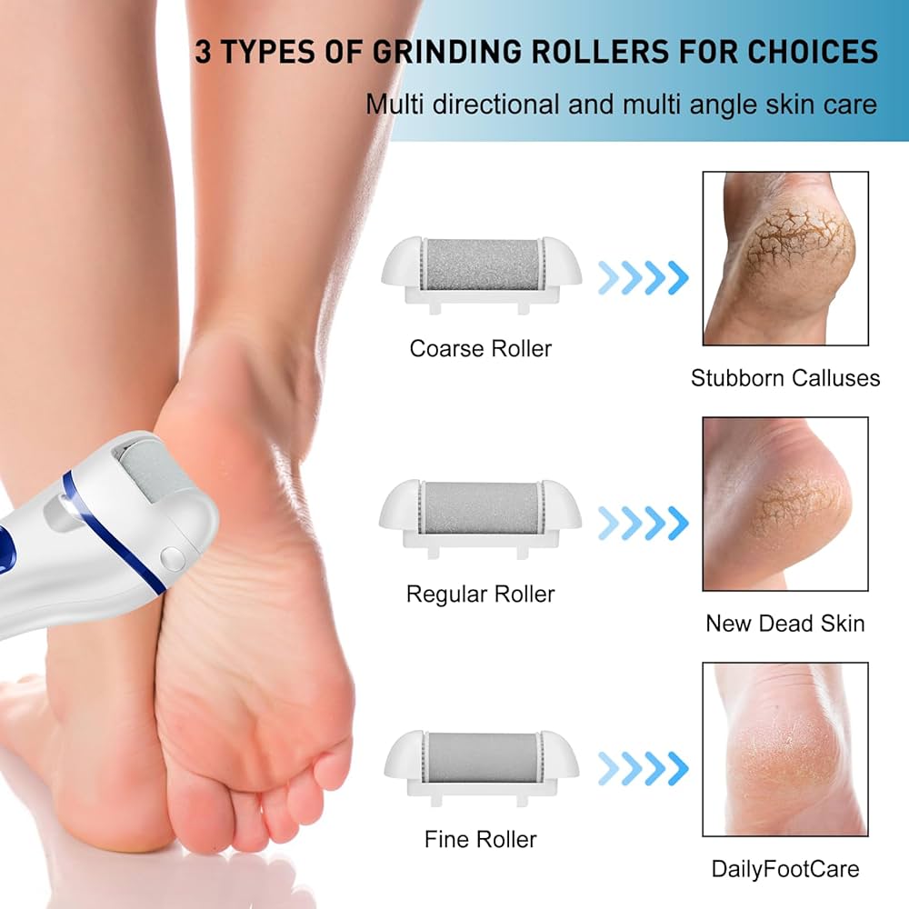 Electric Callus Remover – Baby Feet in minutes