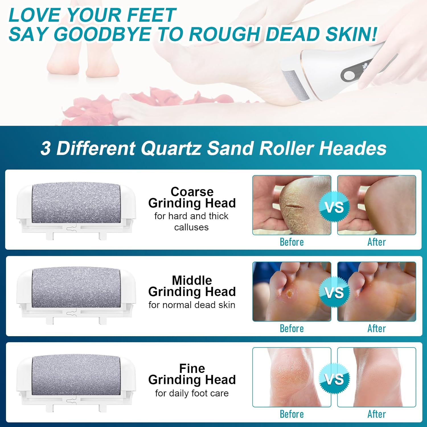 Electric Callus Remover – Baby Feet in minutes